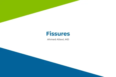 Fissures by Ahmed Allawi
