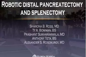 Robotic Distal Pancreatectomy and Splenectomy.