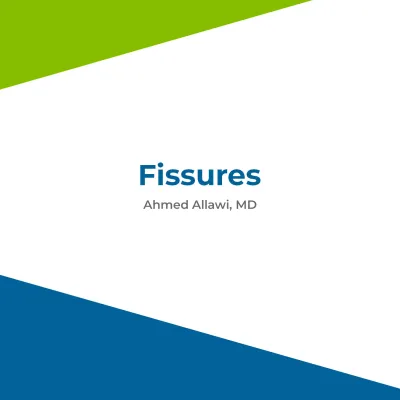 Fissures by Ahmed Allawi