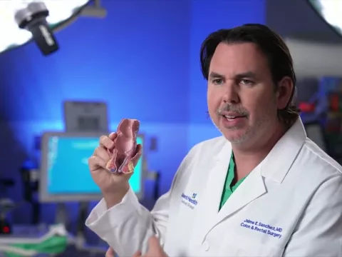 What to do when you get a hemorrhoid? Answered by Dr. Jaime Sanchez